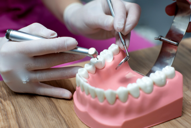 Achieve a Flawless Smile with Dental Crowns in Rockville, MD